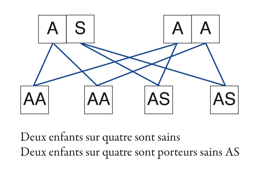 la drépanocytose