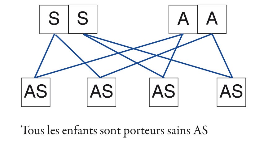 la drépanocytose