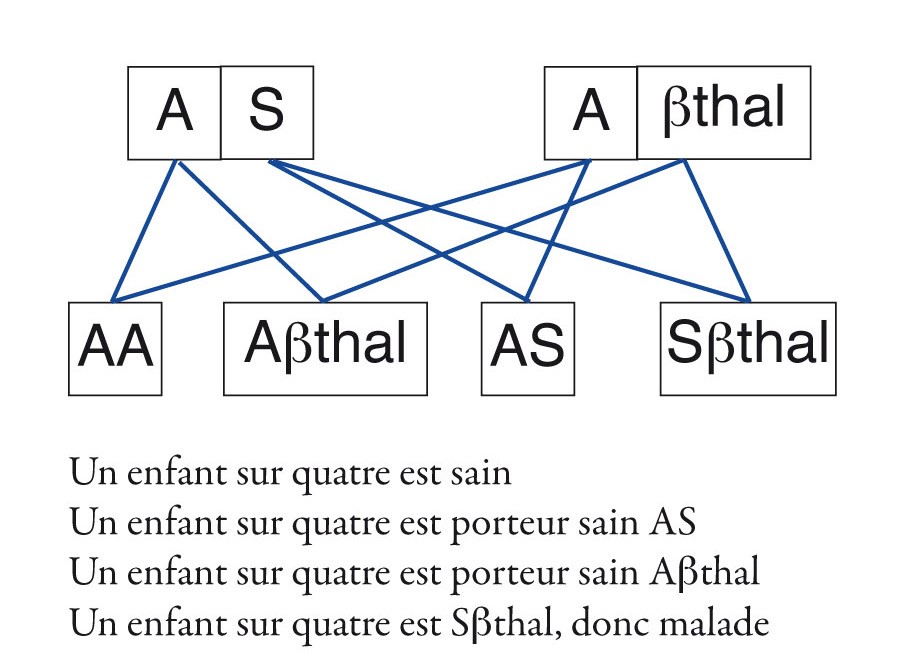 la drépanocytose