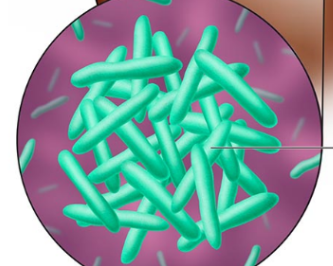 Mycobacterium tuberculosis