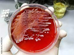 Staphylococcus aureus 