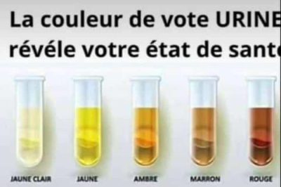 Test d’urine