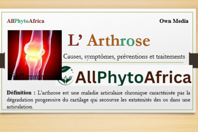 Arthrose 