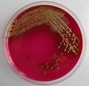 E coli, bactérie à gram négatif