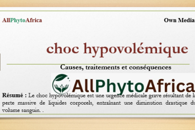 Choc hypovolémique 